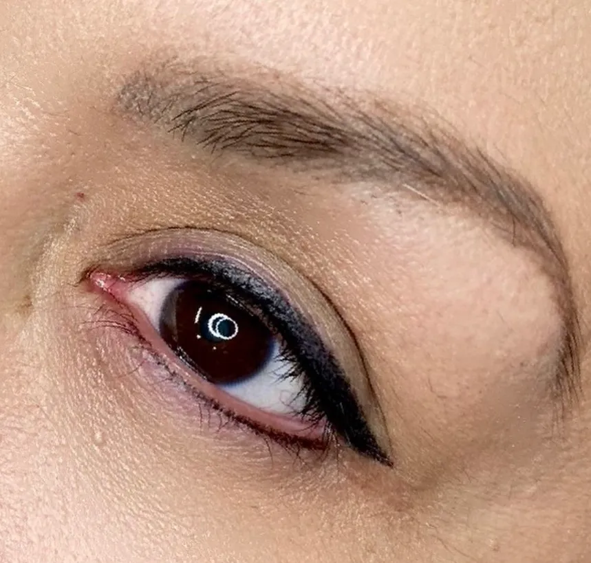 Technique and Equipment