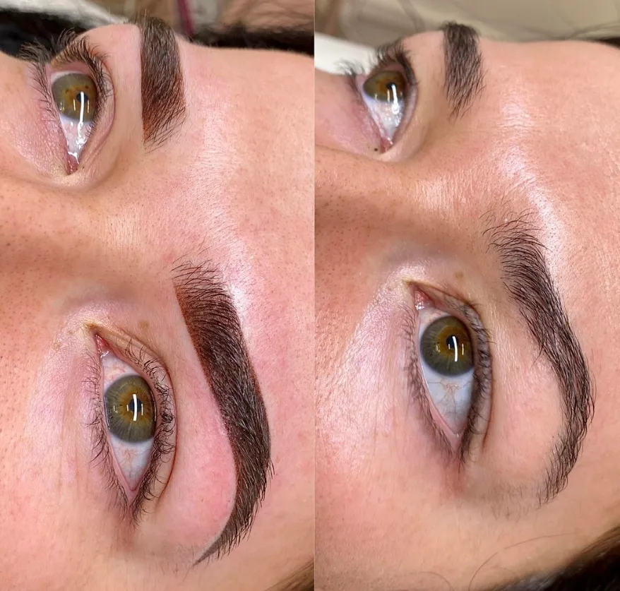 Tips for Oily Skin Clients